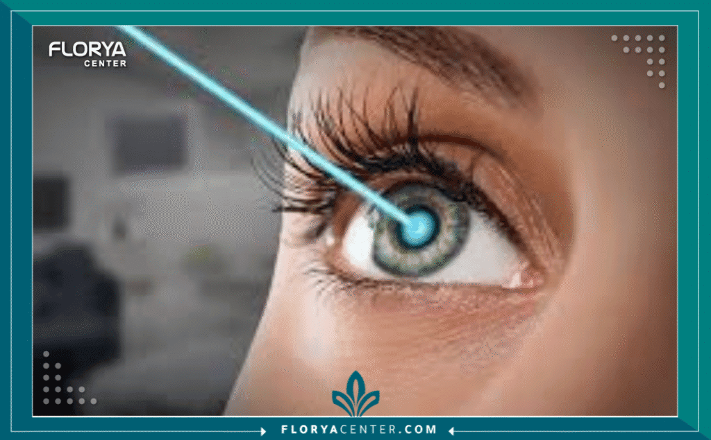 هل تعود المياه البيضاء بعد العملية؟ 4 نسخة من Hayaalaje12 20250623 101722 ٠٠٠٠ 1 - هل تعود المياه البيضاء بعد العملية؟ تعد جراحة إزالة الساد (Cataract Surgery) واحدة من أكثر العمليات الجراحية نجاحاً وشيوعاً على مستوى العالم، حيث تستعيد ملايين العيون وضوح الرؤية سنوياً. ومع ذلك، يواجه بعض المرضى بعد مرور أشهر أو سنوات عودة مفاجئة للضبابية، مما يثير في أذهانهم تساؤلاً جوهرياً ومقلقاً: هل تعود المياه البيضاء بعد العملية؟ وهل يعني هذا فشل الجراحة الأولى؟