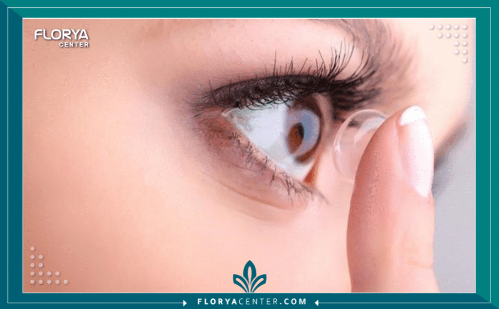 نسخة من Hayaalaje12 20250730 134114 ٠٠٠٠ - هل العدسات اللاصقة آمنة؟ هل العدسات اللاصقة آمنة؟ (Are Contact Lenses Safe) هو السؤال الأكثر تداولاً بين ملايين الأشخاص الذين يبحثون عن حرية بصرية بعيداً عن قيود النظارات الطبية. وفقاً للمراكز الأمريكية للسيطرة على الأمراض والوقاية منها (CDC)، يرتدي ما يقارب 45 مليون شخص في الولايات المتحدة وحدها العدسات اللاصقة، وعلى الرغم من أنها تُصنف كأجهزة طبية آمنة وفعالة عند استخدامها بمسؤولية، إلا أن الإهمال في نظافتها أو تجاوز فترات ارتدائها قد يحولها إلى مصدر خطر يهدد سلامة البصر بشكل دائم. إن الإجابة على سؤال "هل العدسات اللاصقة آمنة؟" ليست مجرد "نعم" أو "لا"، بل هي معادلة دقيقة تعتمد على نوع العدسة، سلوك المريض، ومدى التزامه ببروتوكولات التعقيم الصارمة.