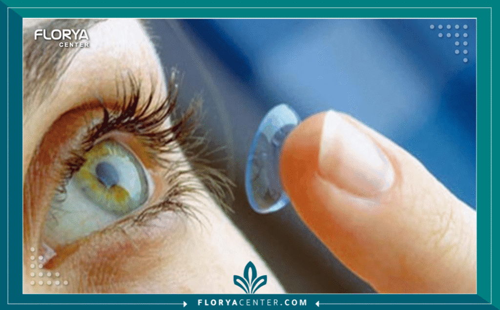 نسخة من Hayaalaje12 20250730 194608 ٠٠٠٠ - كيف أختار نوع العدسة المناسب؟ يُعد قرار استبدال عدسة العين الطبيعية، سواء كان ذلك نتيجة لجراحة المياه البيضاء (Cataract) أو كإجراء لتصحيح النظر الانكساري (RLE)، نقطة تحول مفصلية في حياة المريض. إن السؤال الأكثر إلحاحاً الذي يواجهه المرضى في عيادات العيون اليوم هو: "كيف أختار نوع العدسة المناسب؟" لضمان أفضل جودة رؤية ممكنة مدى الحياة. لم يعد الأمر مقتصراً على إزالة العتامة فحسب، بل أصبح فنّاً طبياً دقيقاً يهدف إلى تصميم رؤية تتناغم مع أسلوب حياة الفرد.