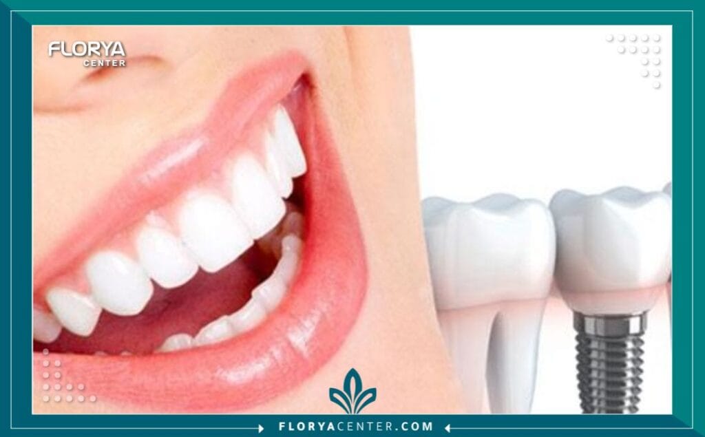 A2 3 - أسعار تركيبات الأسنان في اسطنبول في عالم تجميل الأسنان المتسارع، لم تعد الابتسامة المشرقة مجرد ميزة جمالية عابرة، بل أصبحت ركيزة أساسية للثقة بالنفس وبوابة للتفاعل الاجتماعي الناجح. مع حلول عام 2026، تتجه أنظار العالم بشكل متزايد نحو تركيا، ليس فقط كوجهة سياحية، بل كعاصمة عالمية للطب التجميلي. ولكن، وسط هذا الزخم الهائل من الإعلانات والعروض، يبرز سؤال جوهري يشغل بال كل من يبحث عن التغيير الجذري: ما هي حقيقة أسعار تركيبات الأسنان في اسطنبول، وكيف يمكن ضمان الجودة مقابل التكلفة؟