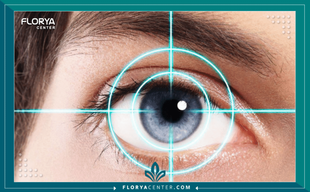 Hayaalaje12 20250628 234449 ٠٠٠٠ - مزايا وعيوب الليزر السطحي تُعد دراسة مزايا وعيوب الليزر السطحي (PRK) الخطوة الحاسمة والذكية لكل من يسعى للتخلص من النظارات الطبية والعدسات اللاصقة، خاصةً لأولئك الذين قيل لهم إن عمليات "الليزك" التقليدية لا تناسبهم. في عالم طب العيون المتسارع، لم تعد عمليات تصحيح البصر مجرد رفاهية، بل أصبحت ضرورة وظيفية تمنح الإنسان حرية الحركة وجودة حياة أفضل. وعلى الرغم من هيمنة مصطلح "الليزك" على مسامع الجمهور، إلا أن مزايا وعيوب الليزر السطحي تبرز كخيار "المنقذ" للحالات المعقدة، مثل القرنيات الرقيقة، لتقدم حلاً جذرياً وآمناً أثبت فعاليته على مدار عقود.