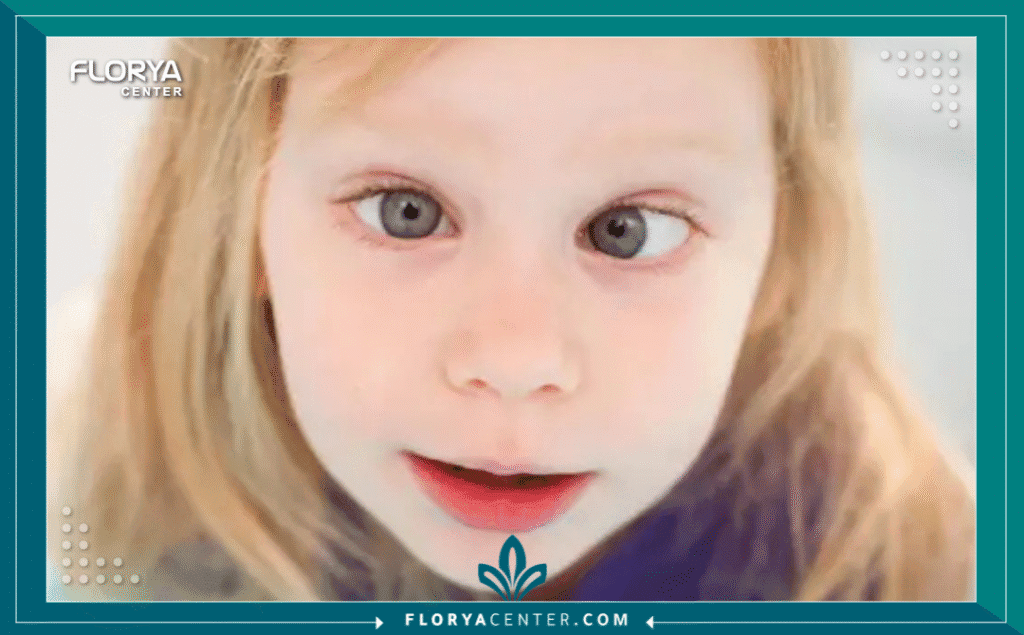 Hayaalaje12 20250706 161506 ٠٠٠٠ - طب عيون الأطفال والحول يُعد طب عيون الأطفال والحول (Pediatric Ophthalmology and Strabismus) من أكثر التخصصات الطبية دقة وحساسية، حيث لا يقتصر الهدف فيه على تصحيح النظر فحسب، بل يمتد ليشمل حماية التطور العصبي والدماغي للطفل. تشير الإحصاءات الطبية إلى أن اكتشاف مشاكل الإبصار في السنوات الأولى يمكن أن يمنع فقدان البصر الدائم بنسبة تصل إلى 95%. إن التدخل المبكر ليس خياراً ترفيهياً، بل هو ضرورة قصوى لضمان نمو بصري سليم، وتجنب مشاكل "الكسل البصري" التي قد تلازم الطفل مدى الحياة. في هذا الدليل الشامل، سنغوص في عمق التشخيص الدقيق والحلول الجراحية وغير الجراحية المتقدمة.