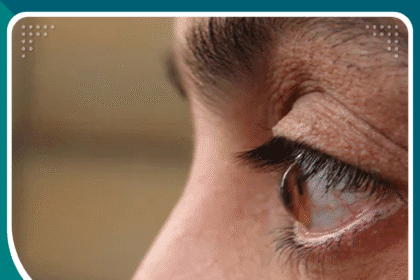 أسباب القرنية المخروطية عند الشباب