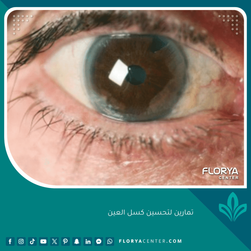 تمارين لتحسين كسل العين