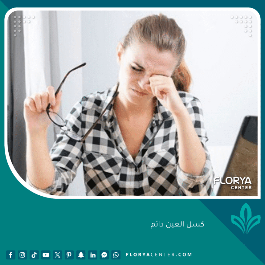 كسل العين دائم