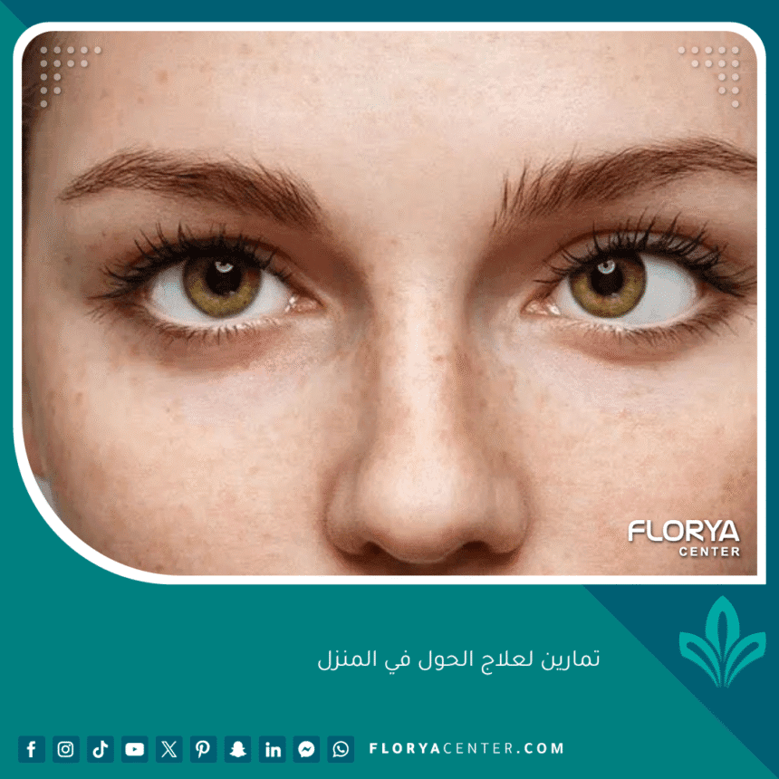 تمارين لعلاج الحول في المنزل