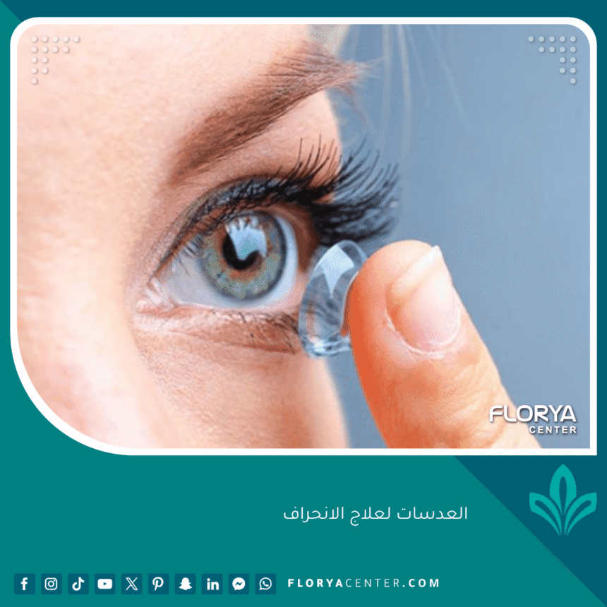 العدسات لعلاج الانحراف