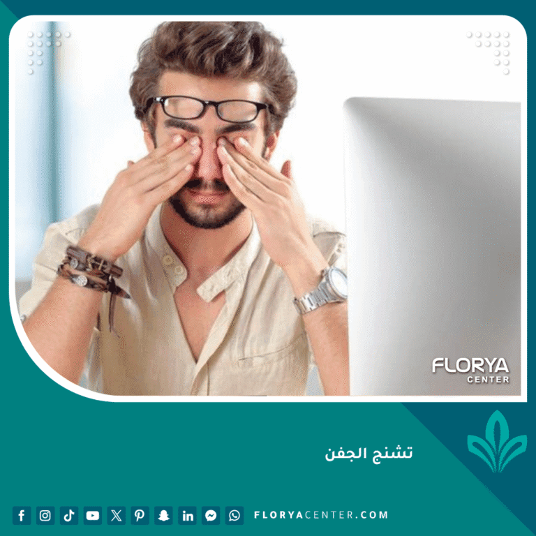 تشنج الجفن