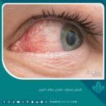 أفضل قطرات لعلاج جفاف العين