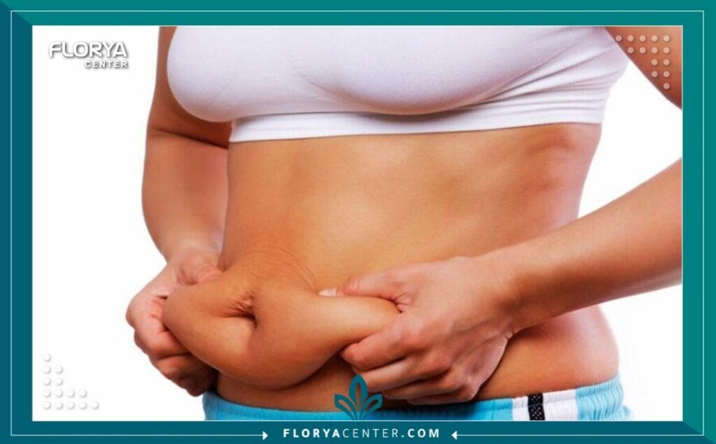 bb2 2 - شد البطن في اسطنبول في السعي نحو استعادة الثقة وتناسق القوام، برزت عملية شد البطن في اسطنبول Tummy tuck in Istanbul كواحدة من أكثر الإجراءات التجميلية الجراحية طلباً وفعالية على مستوى العالم. لم يعد الحصول على بطن مسطح ومشدود حلماً بعيد المنال، خاصة بعد التغيرات الكبيرة التي قد تطرأ على الجسم نتيجة الحمل المتكرر، أو فقدان الوزن الكبير، أو حتى تأثيرات الشيخوخة الطبيعية. تُعرف هذه العملية عالمياً باسم (Abdominoplasty)، وهي تمثل الحل الجذري للجلد الزائد والدهون العنيدة التي لا تستجيب للتمارين الرياضية أو الحميات الغذائية.