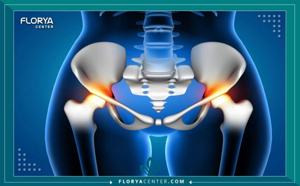 cc3 4 - جراحة العظام والمفاصل في اسطنبول تعد جراحة العظام والمفاصل في اسطنبول اليوم واحدة من أكثر الوجهات الطبية استقطاباً للمرضى حول العالم، خاصة أولئك الذين يعانون من آلام مزمنة في الحركة أو إصابات رياضية معقدة تتطلب تدخلاً جراحياً دقيقاً. إن اللجوء إلى جراحة العظام والمفاصل في اسطنبول لا يعني فقط الحصول على علاج طبي، بل هو استثمار في استعادة جودة الحياة وحرية الحركة باستخدام أحدث التقنيات العالمية. لقد أثبتت جراحة العظام والمفاصل في اسطنبول كفاءتها العالية بفضل دمج الخبرات الجراحية مع التكنولوجيا الروبوتية المتقدمة، مما يجعلها الخيار الأول للمرضى من أوروبا والشرق الأوسط.عندما نتحدث عن جراحة العظام والمفاصل في اسطنبول، فإننا نشير إلى منظومة طبية متكاملة تشمل تشخيص وعلاج أمراض الجهاز العضلي الهيكلي