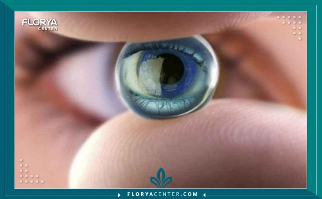 ee3 3 - تكلفة زراعة العدسات في اسطنبول هل تخطط لاستعادة حدة بصرك وتتساءل عن تفاصيل تكلفة زراعة العدسات في اسطنبول (Phakic IOL Cost in Istanbul) لعام 2026؟ إن اتخاذ قرار الخضوع لجراحة داخل العين ليس مجرد إجراء طبي، بل هو خطوة مصيرية نحو استعادة "هويتك البصرية" ونمط حياتك الحر بعيداً عن قيود النظارات أو العدسات اللاصقة التقليدية. بينما يبحث الكثيرون عن الأرقام المجردة، يغفل البعض أن نجاح هذه العملية يتطلب دقة مجهرية للحفاظ على صحة القرنية وأنسجة العين الداخلية، تماماً كما تتطلب العمليات الدقيقة الأخرى نحتاً خاصاً للحفاظ على الملامح الطبيعية. هذا الدليل ليس مجرد سرد للأسعار، بل هو خارطة طريق تضع بين يديك الأرقام الحقيقية، المخاطر الخفية، وكيفية ضمان استثمارك في المكان الصحيح لنتائج تدوم مدى الحياة.