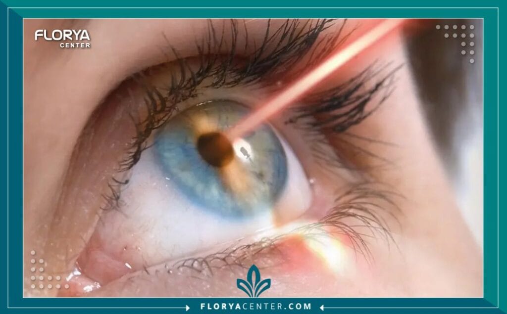 ee5 3 - تكلفة زراعة العدسات في اسطنبول هل تخطط لاستعادة حدة بصرك وتتساءل عن تفاصيل تكلفة زراعة العدسات في اسطنبول (Phakic IOL Cost in Istanbul) لعام 2026؟ إن اتخاذ قرار الخضوع لجراحة داخل العين ليس مجرد إجراء طبي، بل هو خطوة مصيرية نحو استعادة "هويتك البصرية" ونمط حياتك الحر بعيداً عن قيود النظارات أو العدسات اللاصقة التقليدية. بينما يبحث الكثيرون عن الأرقام المجردة، يغفل البعض أن نجاح هذه العملية يتطلب دقة مجهرية للحفاظ على صحة القرنية وأنسجة العين الداخلية، تماماً كما تتطلب العمليات الدقيقة الأخرى نحتاً خاصاً للحفاظ على الملامح الطبيعية. هذا الدليل ليس مجرد سرد للأسعار، بل هو خارطة طريق تضع بين يديك الأرقام الحقيقية، المخاطر الخفية، وكيفية ضمان استثمارك في المكان الصحيح لنتائج تدوم مدى الحياة.