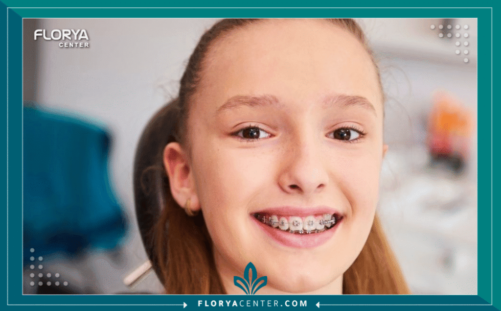 سعر تقويم الأسنان في تركيا