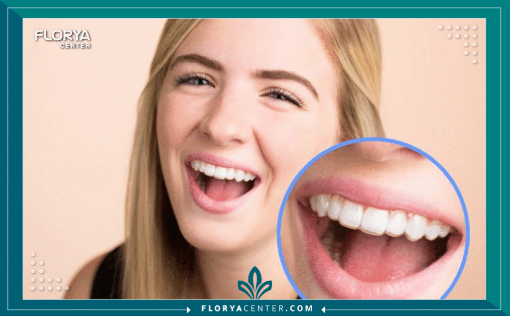 nouralagee93@gmail.com 20250723 112156 ٠٠٠٠ - مثبت التقويم بعد العلاج يُعد مثبت التقويم بعد العلاج (Orthodontic Retainers after Treatment) الخطوة الأكثر أهمية وحسمًا في رحلة تصحيح الابتسامة، فهو الضمان الحقيقي للحفاظ على النتائج التي تم تحقيقها بشق الأنفس. يعتقد الكثيرون أن إزالة أسلاك التقويم هي نهاية المطاف، لكن الحقيقة الطبية، كما تؤكدها الأكاديمية الأمريكية لتقويم الأسنان (AAO)، هي أن مرحلة التثبيت هي البداية الحقيقية للحفاظ على الاستثمار المالي والوقتي. بدون الالتزام بـ "مثبت التقويم بعد العلاج"، تبدأ الأسنان في العودة التدريجية إلى وضعها الأصلي، وهي ظاهرة تُعرف بـ "الانتكاس" (Relapse).