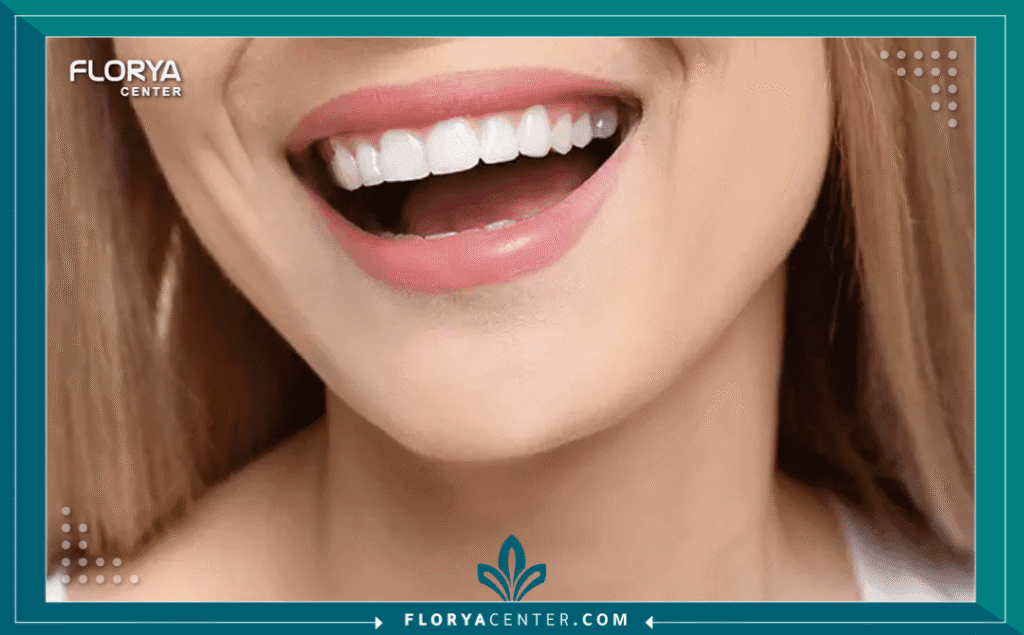 nouralagee93@gmail.com 20250731 161550 ٠٠٠٠ - ما هي ابتسامة هوليود؟ ما هي ابتسامة هوليود؟ (Hollywood Smile) هي ليست إجراءً طبياً محدداً بحد ذاته، بل هي مفهوم تجميلي شامل يهدف إلى تحقيق مظهر أسنان مثالي يتسم بالبياض الناصع، الاصطفاف المتكامل، والشكل المتناسق الذي نراه غالباً لدى المشاهير. على عكس الاعتقاد الشائع، لا يوجد إجراء واحد يسمى "ابتسامة هوليود"، بل هي النتيجة النهائية لمجموعة من إجراءات طب الأسنان التجميلي المصممة خصيصاً لكل فرد. في قلب هذا التحول الجمالي، تبرز "القشور الخزفية" (Veneers) باعتبارها الحجر الأساسي والأداة الأكثر فعالية لتحقيق هذا المظهر.