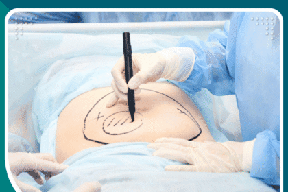 عمليات البطن