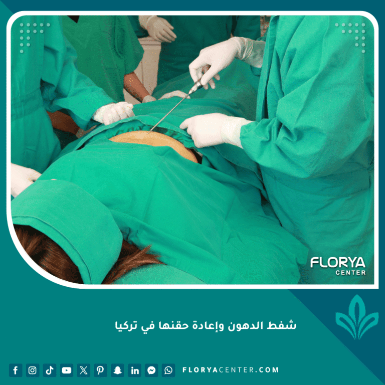 شفط الدهون وإعادة حقنها في تركيا