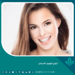 أنواع تقويم الأسنان