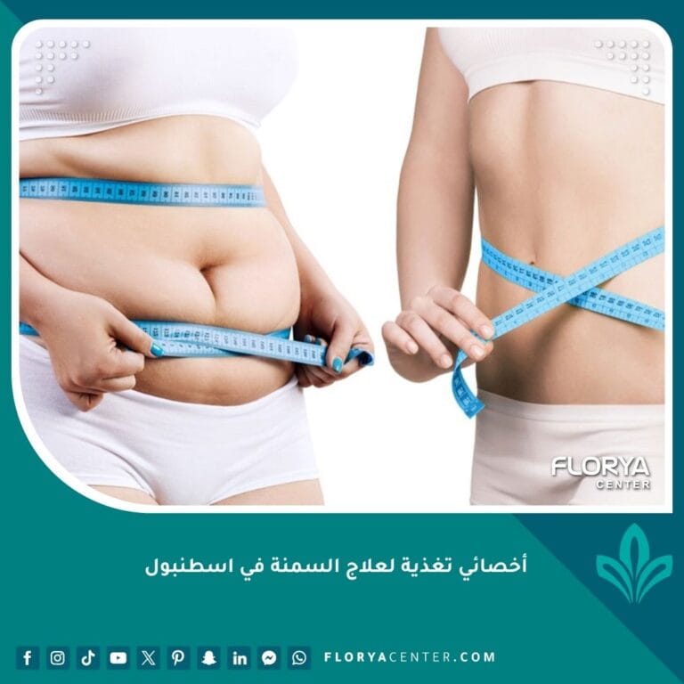 أخصائي تغذية لعلاج السمنة في اسطنبول