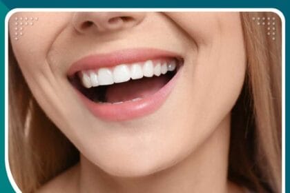 أسعار تركيبات الأسنان في اسطنبول