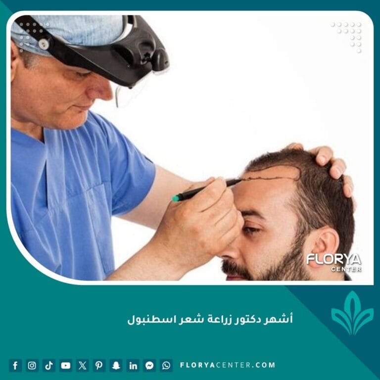أشهر دكتور زراعة شعر اسطنبول