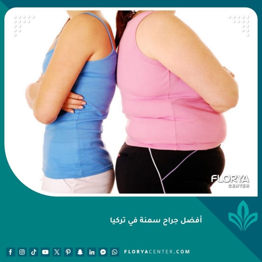 أفضل جراح سمنة في تركيا