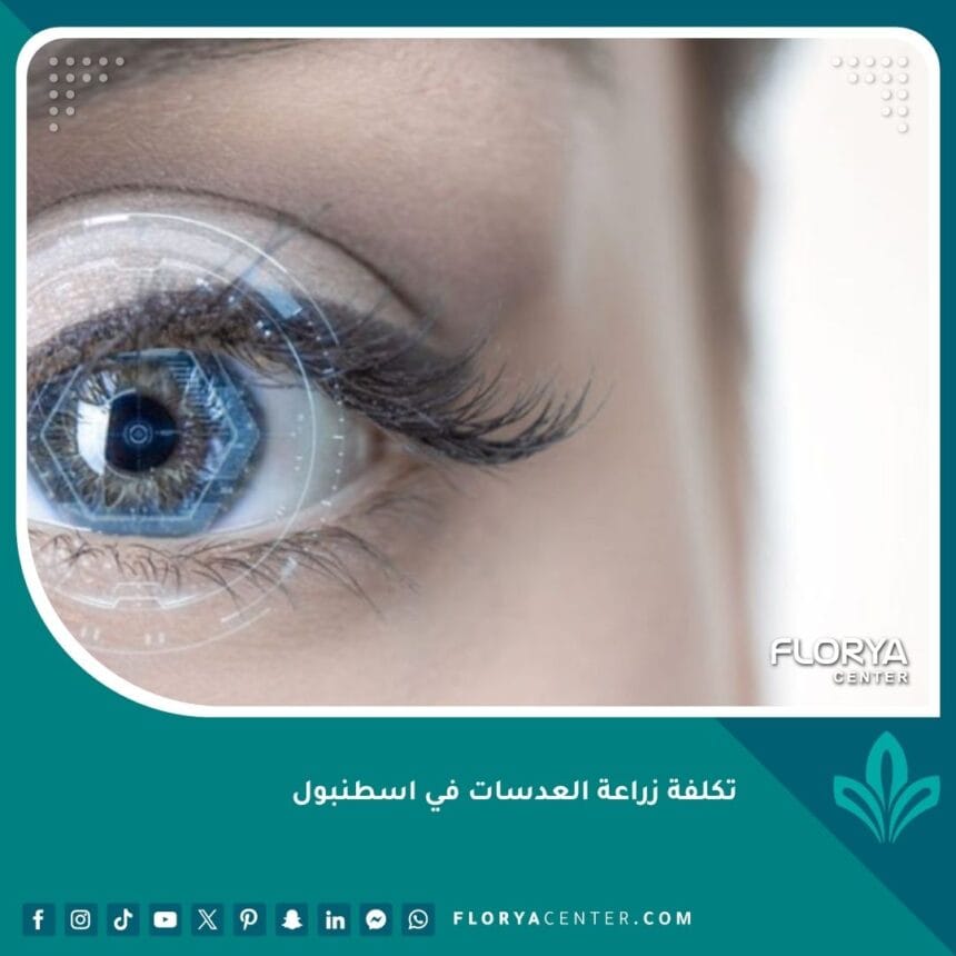 تكلفة زراعة العدسات في اسطنبول