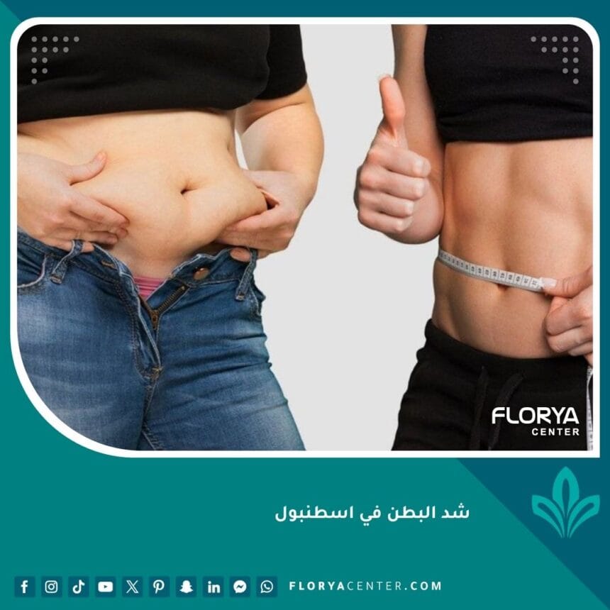 شد البطن في اسطنبول