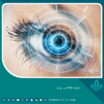 تكلفة PRK في تركيا