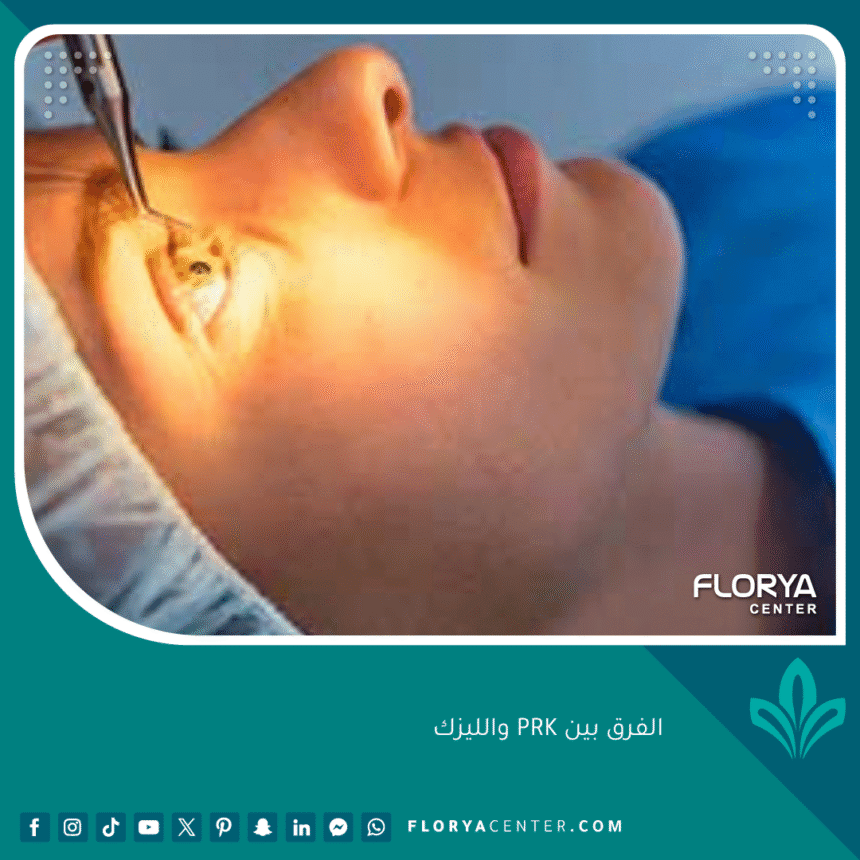 الفرق بين PRK والليزك