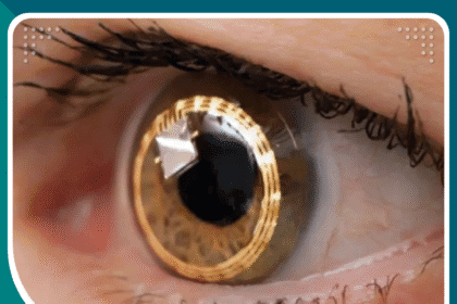 تصحيح الإبصار