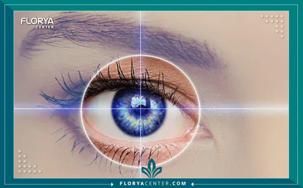 نسخة من Hayaalaje12 20250801 225858 ٠٠٠٠ - تجارب عملية PRK تعتبر تجارب عملية PRK للعيون من أكثر المواضيع التي يبحث عنها المرضى الراغبون في تصحيح النظر بدقة وأمان، خاصة أولئك الذين قيل لهم إن الليزك التقليدي لا يناسبهم. في عالم طب العيون، يمثل قرار الخضوع لعملية تصحيح النظر خطوة مفصلية، ولكن عملية PRK للعيون تختلف بشكل جذري عن تجارب الليزك أو الفيمتو سمايل، لا سيما في مرحلة التعافي. إن فهمك العميق لواقع عملية PRK للعيون سيحميك من المفاجآت ويساعدك على تجاوز الأيام الأولى بثبات. في مركز فلوريا، نؤمن بأن المريض المثقف هو شريك في نجاح العملية، ولذلك أعددنا هذا الدليل المرجعي لنغوص معاً في تفاصيل تجارب عملية PRK للعيون من منظور طبي وإنساني.