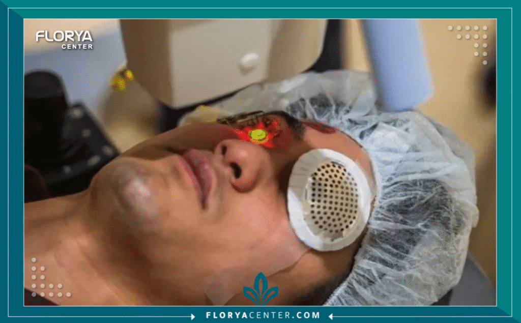 نسخة من Hayaalaje12 20250805 020335 ٠٠٠٠ 2 - تجارب CXL تُعد حاسة البصر هي النافذة التي نطل منها على العالم، وأي تهديد يمس وضوح هذه الرؤية يمثل تحدياً نفسياً وجسدياً كبيراً. تبرز تجارب CXL (عملية تثبيت القرنية المخروطية) كطوق نجاة حقيقي وآمن لملايين الأشخاص حول العالم ممن يعانون من القرنية المخروطية (Keratoconus). إن الحديث عن تجارب CXL لا يقتصر فقط على الإجراء الطبي، بل يمتد ليشمل رحلة البحث عن الاستقرار البصري ومنع تدهور الحالة الذي قد يؤدي لنتائج لا تُحمد عقباها مثل زراعة القرنية.