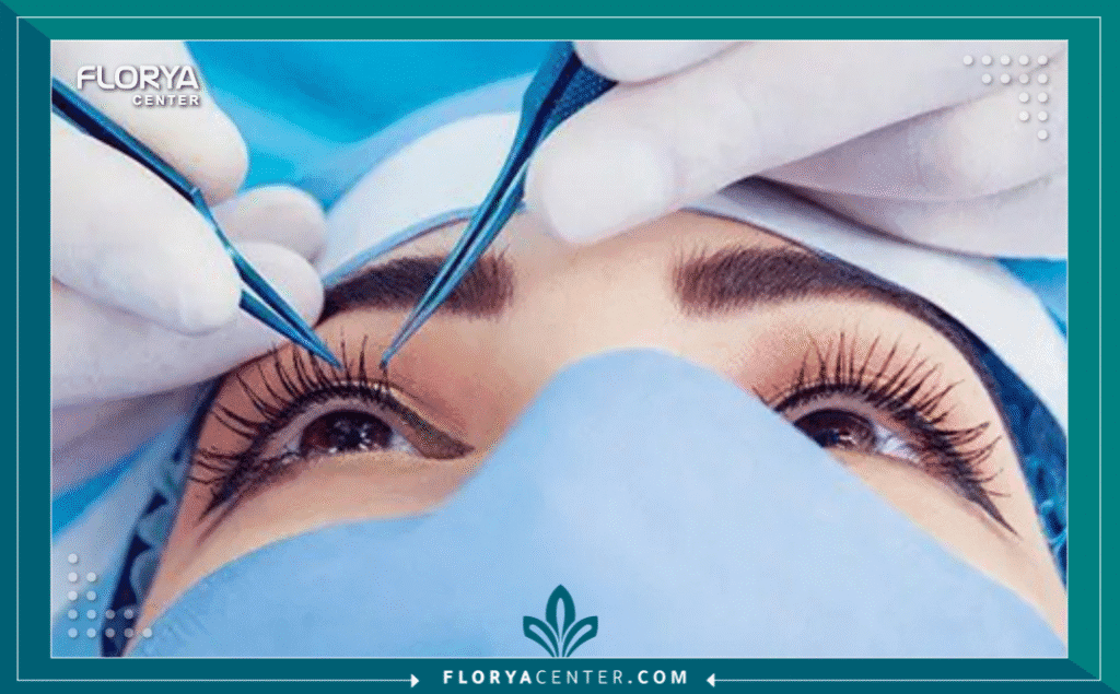 نسخة من Hayaalaje12 20250805 020550 ٠٠٠٠ - تجارب CXL تُعد حاسة البصر هي النافذة التي نطل منها على العالم، وأي تهديد يمس وضوح هذه الرؤية يمثل تحدياً نفسياً وجسدياً كبيراً. تبرز تجارب CXL (عملية تثبيت القرنية المخروطية) كطوق نجاة حقيقي وآمن لملايين الأشخاص حول العالم ممن يعانون من القرنية المخروطية (Keratoconus). إن الحديث عن تجارب CXL لا يقتصر فقط على الإجراء الطبي، بل يمتد ليشمل رحلة البحث عن الاستقرار البصري ومنع تدهور الحالة الذي قد يؤدي لنتائج لا تُحمد عقباها مثل زراعة القرنية.