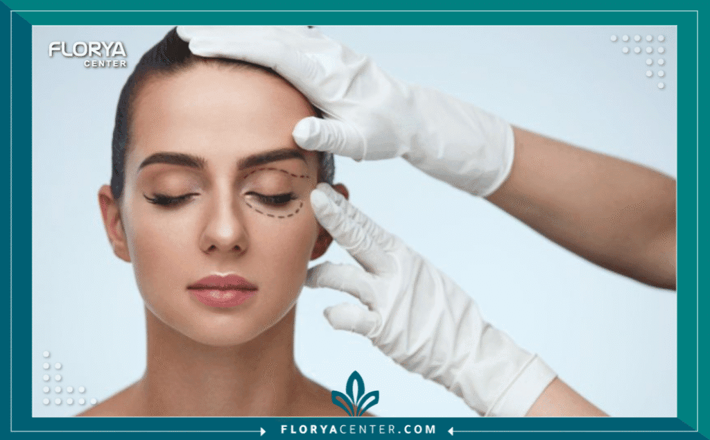 نسخة من Hayaalaje12 20250809 220839 ٠٠٠٠ 1 - عيادة تجميل العيون في اسطنبول تعتبر عيادة تجميل العيون في اسطنبول وجهة عالمية أولى لكل من يسعى لاستعادة شباب الوجه وإشراقة النظرة، حيث أصبحت تركيا اليوم مركزاً إقليمياً ودولياً في جراحات تجميل الجفون (Blepharoplasty) وتصحيح العيون. إن اختيارك لأي عيادة تجميل العيون في اسطنبول يجب أن يستند إلى معايير طبية صارمة تضمن لك الأمان والجمال في آن واحد، بعيداً عن المخاطر المرتبطة بالعمليات غير الدقيقة.