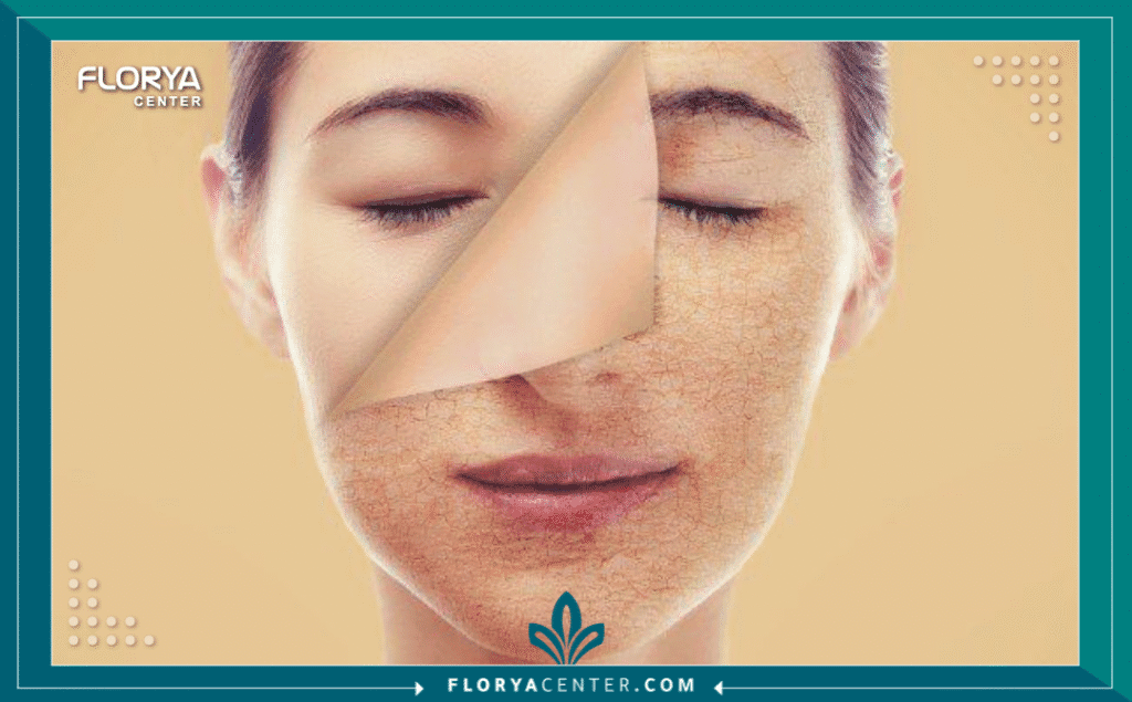 نسخة من Hayaalaje12 20250813 002852 ٠٠٠٠ - عيادات تجميل في تركيا أصبح البحث عن عيادات تجميل في تركيا هو البوابة الأولى لملايين الأشخاص حول العالم الراغبين في تغيير حياتهم ومظهرهم للأفضل. لم تعد إسطنبول مجرد مدينة سياحية، بل تحولت إلى عاصمة عالمية للطب التجميلي، حيث تتنافس آلاف العيادات لتقديم أفضل الخدمات. ولكن، وسط هذا الزحام الهائل، يظهر التحدي الحقيقي: كيف تختار العيادة التي تمنحك "الخصوصية"، "النتائج الطبيعية"، و"الأمان الطبي" بعيداً عن المستشفيات المزدحمة ذات الطابع التجاري البحت؟