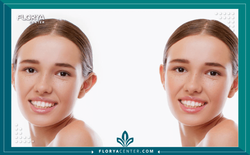 نسخة من Hayaalaje12 20250817 135329 ٠٠٠٠ - جراح تجميل الأذن في تركيا جراح تجميل الأذن في تركيا هو المقصد الأول لآلاف المرضى سنويًا الذين يسعون لتصحيح شكل الأذن وتحسين المظهر العام للوجه. ومع حلول عام 2026، أصبحت تركيا المركز العالمي الرائد في هذا التخصص الطبي الدقيق، حيث تجمع بين المهارة الجراحية الفائقة والتكنولوجيا المتطورة.