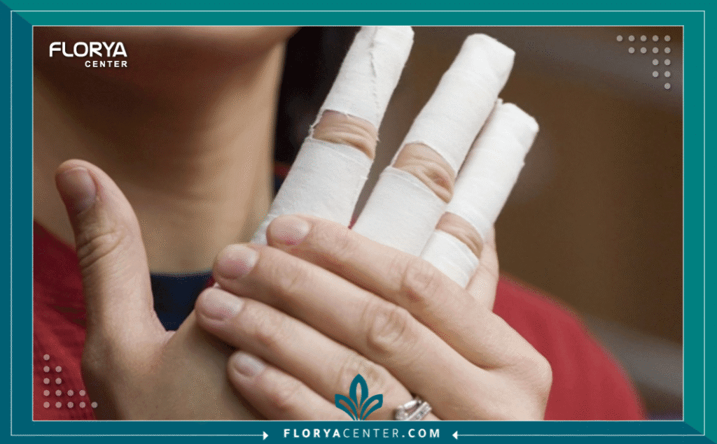 نسخة من Hayaalaje12 20250819 234012 ٠٠٠٠ - جراحة تجميل اليدين في تركيا تُعد جراحة تجميل اليدين في تركيا (Hand Rejuvenation Surgery in Turkey) واحدة من أكثر الإجراءات الدقيقة تطوراً في عالم الطب التجميلي الحديث، حيث تهدف إلى معالجة علامات الشيخوخة التي تظهر بوضوح على ظهر اليدين قبل أي منطقة أخرى في الجسم. إن فقدان طبقة الدهون تحت الجلد، وبروز الأوردة والأوتار، وظهور التصبغات الجلدية، كلها عوامل تجعل اليدين تبدوان أكبر سناً من العمر الحقيقي، مما يدفع الآلاف سنوياً للبحث عن جراحة تجميل اليدين في تركيا كحل جذري وفعال.