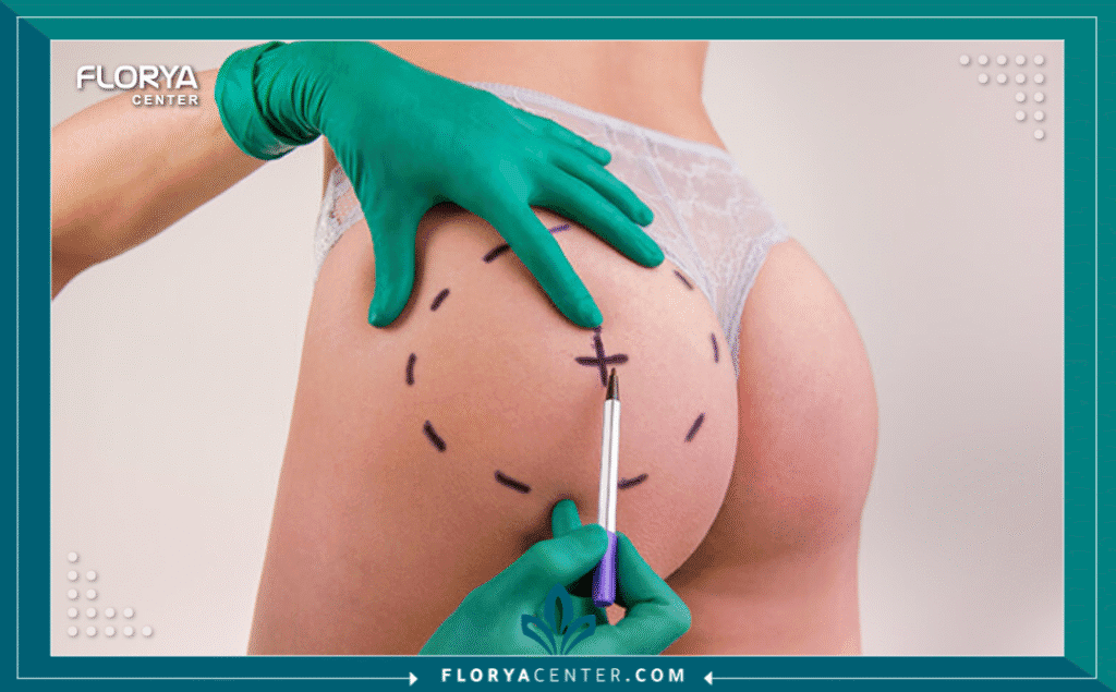 نسخة من Hayaalaje12 20250823 142304 ٠٠٠٠ - عمليات تكبير المؤخرة في اسطنبول هل تحلمين بامتلاك قوام "الساعة الرملية" المتناسق الذي يجمع بين الخصر المنحوت والمنحنيات الأنثوية الجذابة؟ إن عمليات تكبير المؤخرة في اسطنبول (Buttock Augmentation) لم تعد مجرد صيحة تجميلية عابرة، بل أصبحت بوابتك الذهبية لاستعادة الثقة بالنفس وتصحيح معالم الجسم التي قد لا تستجيب للرياضة القاسية. في عصرنا الحالي، تجاوزت هذه الإجراءات المفهوم التقليدي للجراحة لتصبح فناً طبياً دقيقاً يعيد تشكيل التوازن الجسدي.