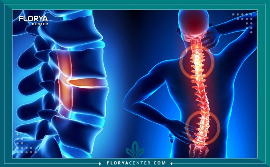 B1 2 - أفضل مستشفى لعمليات العمود الفقري في تركيا هل تعاني من آلام الظهر المزمنة التي أوقفت حياتك؟ هل تبحث عن حل جذري وآمن في مستشفى لعمليات العمود الفقري في تركيا يجمع بين الخبرة العالمية والتكلفة المدروسة؟ إن قرار الخضوع لجراحة في العمود الفقري هو بلا شك أحد أهم القرارات التي قد تتخذها في حياتك، وهو قرار لا يحتمل الخطأ أو التجربة.