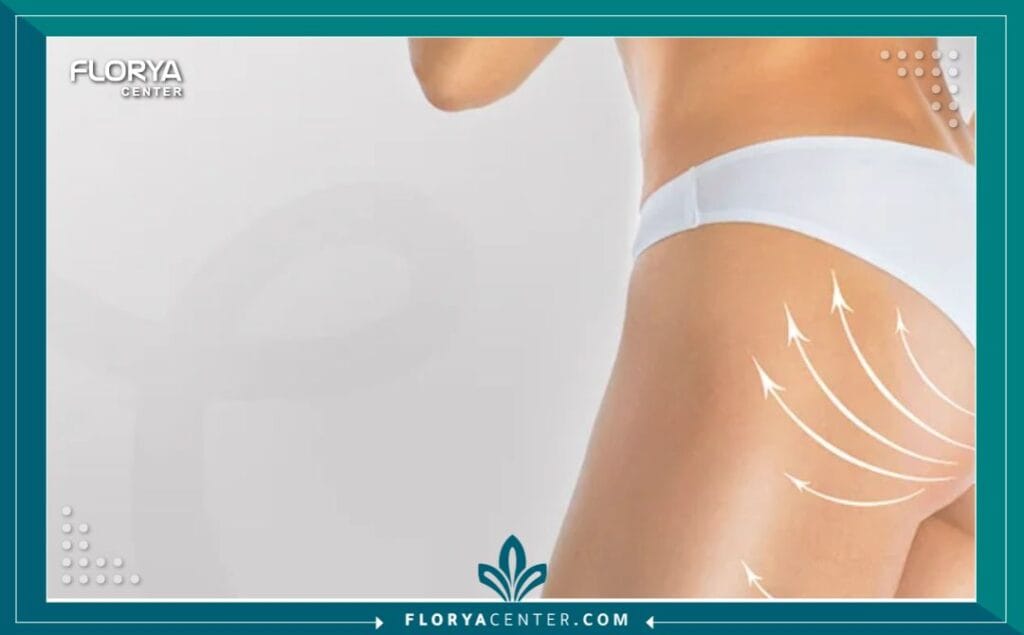 C4 1 - عمليات تجميل الأرداف والسيقان في تركيا هل تشعرين بأن عدم تناسق النصف السفلي من جسمك يقف حاجزاً أمام ثقتك بنفسك واختيارك للملابس التي تحبين؟ إن عمليات تجميل الأرداف والسيقان في تركيا (Lower Body Contouring) لم تعد مجرد رفاهية تجميلية، بل تحولت إلى حل جذري وفعال لاستعادة التوازن الجسدي والنفسي الذي طالما حلمتِ به. مع التطور الطبي الهائل، أصبح بإمكانك الآن نحت القوام بدقة متناهية، والتخلص من الترهلات العنيدة، والحصول على منحنيات أنثوية جذابة بأمان تام. تركيا اليوم ليست مجرد وجهة سياحية، بل هي عاصمة الطب التجميلي التي يقصدها الآلاف سنوياً لتحويل أحلامهم إلى واقع ملموس، مستفيدين من خبرات جراحية عالمية وتقنيات لا تتوفر بسهولة في أماكن أخرى.