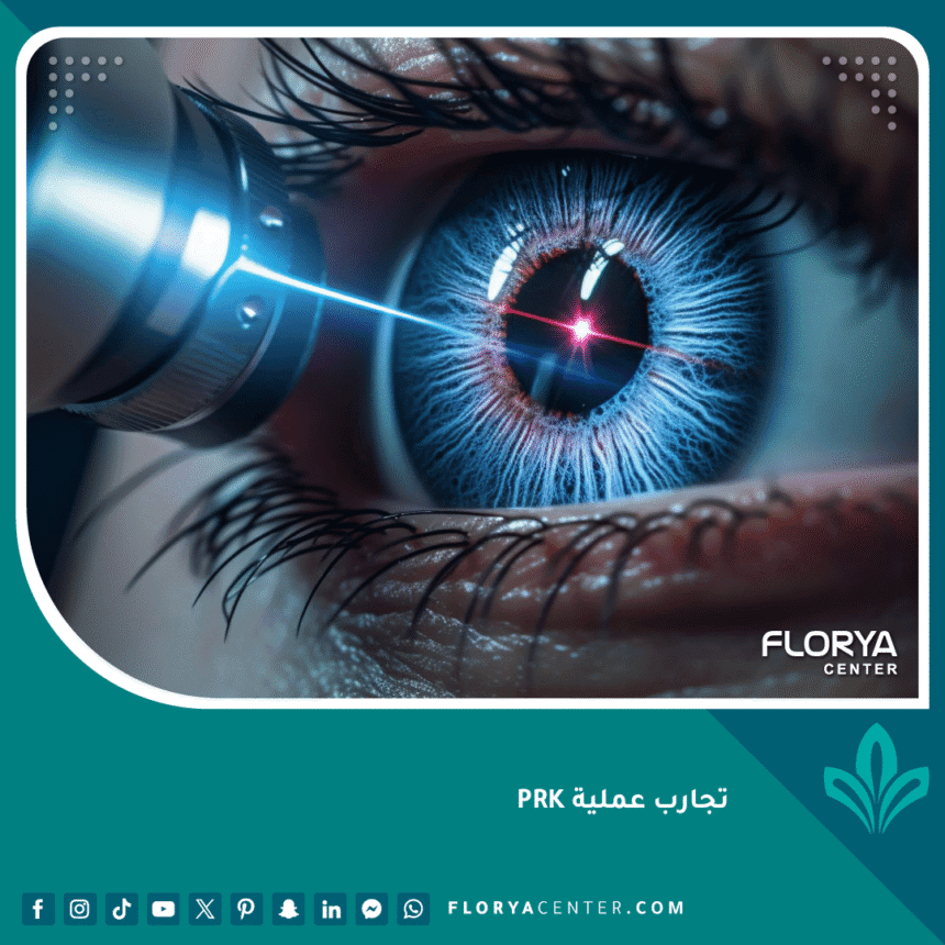 تجارب عملية PRK