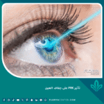 تأثير PRK على جفاف العين