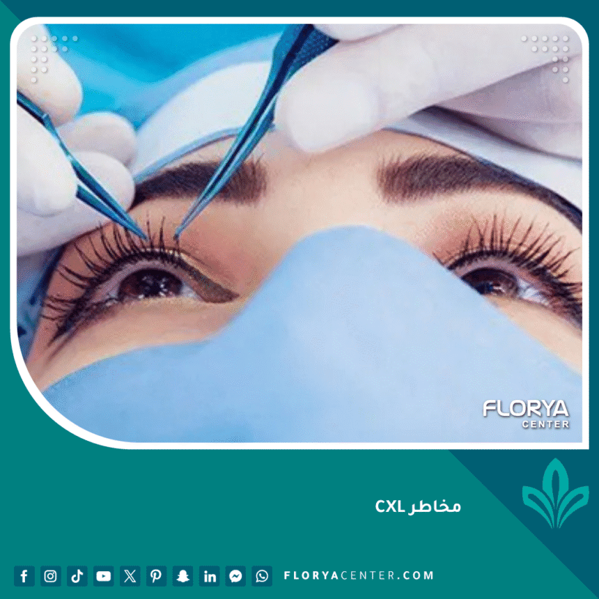 مخاطر CXL