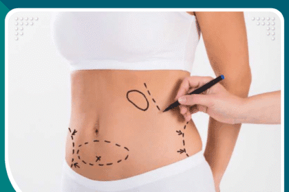 دكتور تجميل المشاهير في تركيا