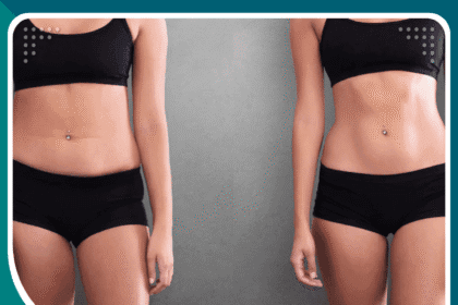 مراكز عمليات التجميل في تركيا