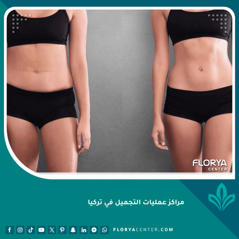 مراكز عمليات التجميل في تركيا