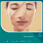 التجميل في تركيا