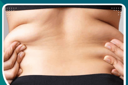 جراحة شد الترهلات في تركيا